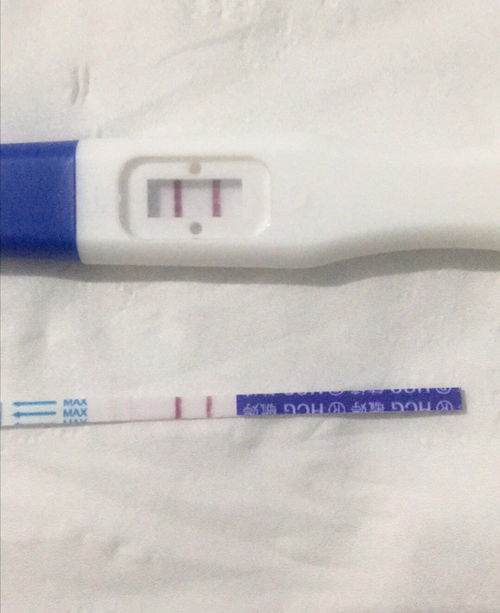 40岁还可以通过试管婴儿生宝宝吗？权威解答与注意事项